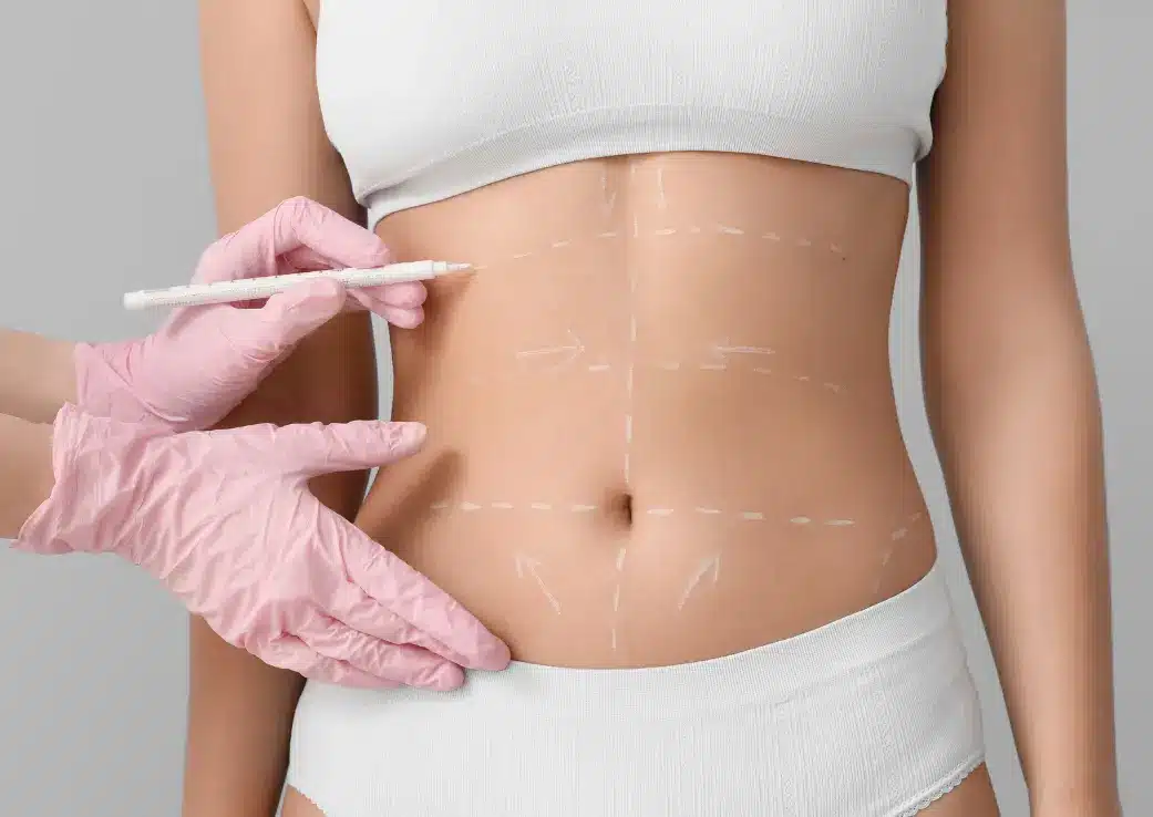 A surgeon performing liposuction surgery in a Turkish clinic.